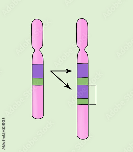 gene duplication sample. Chromosome abnormalities - deletion, duplication, inversion