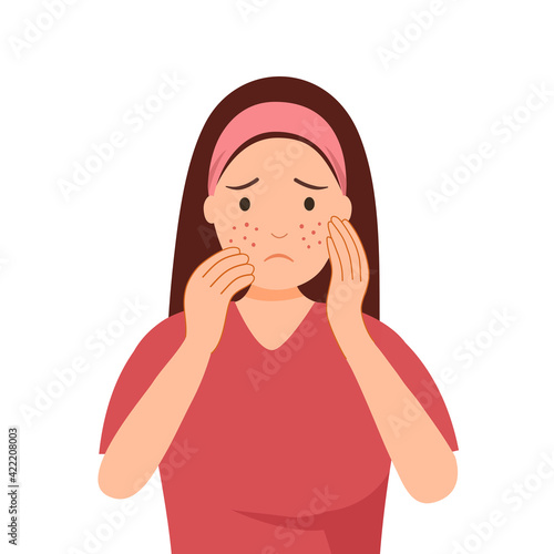 Young woman worrying about her acne on face in flat design. Pimple problem on female skin.