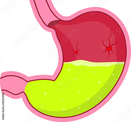 Examination of the stomach. Stomach health or disease. Doctor's conclusion.