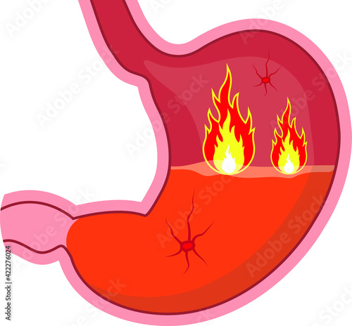 Examination of the stomach. Stomach health or disease. Doctor's conclusion.