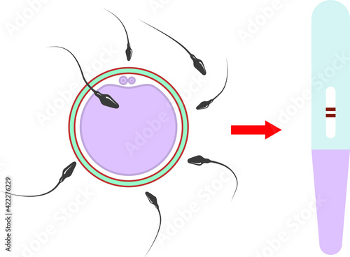 Artificial fertilization of an egg. Pregnancy.