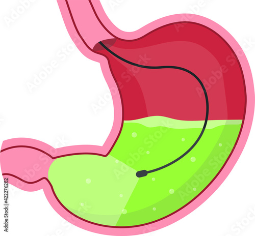 Examination of the stomach. Stomach health or disease. Doctor's conclusion.