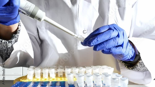 Laboratory researcher or nurse pipets patient sample into a test tube. Genetic engineering or genetic disease screening. Cancer and drug research and science