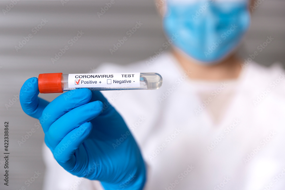 Close up of unrecognizable doctor holding a test tube with a positive sample of Covid-19 virus. Selective focus, space for text.
