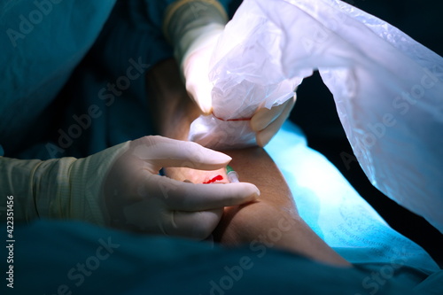Photos Doctor use puncture needle with vascular ultrasound guide for prepare peripheral vascular angiography