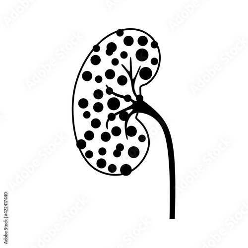 Kidney disease concept
