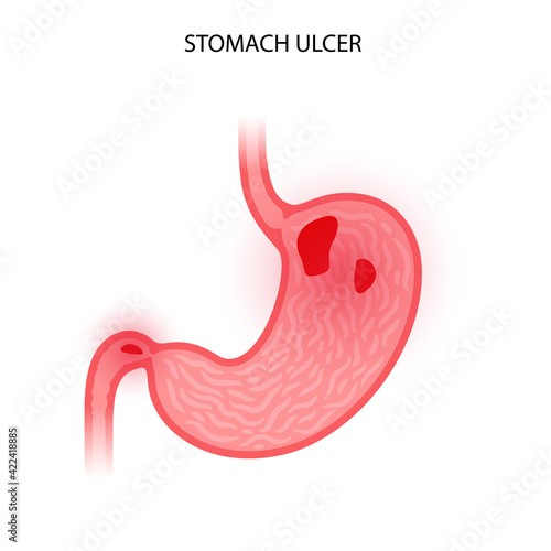 Stomach logo concept