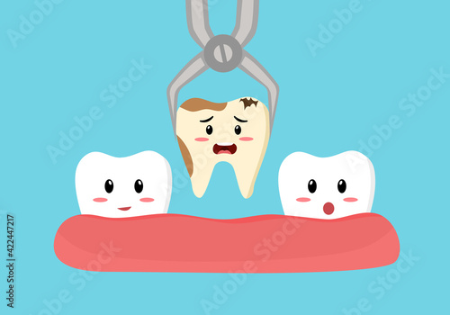 Tooth is removed by forceps in oral cavity. Cute cartoon of cavity tooth concept vector illustration. Dental treatment by dentist.