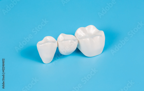 Plastic dental crowns, imitation of a dental prosthesis of a dental bridge