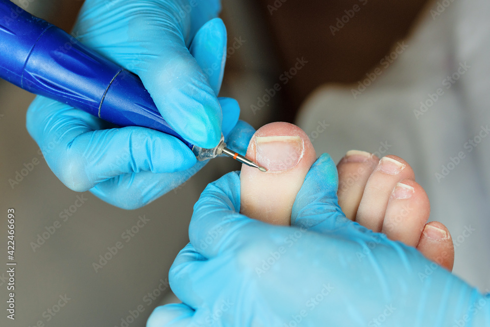 Hardware pedicure, preparation of the nail plate for applying gel polish. Master chiropody shapes the nails. Female patient in the process of hardware pedicure procedure. Foot care Hardware pedicure, preparation of the nail plate for applying gel polish. Master chiropody shapes the nails. Female patient in the process of hardware pedicure procedure. Foot care