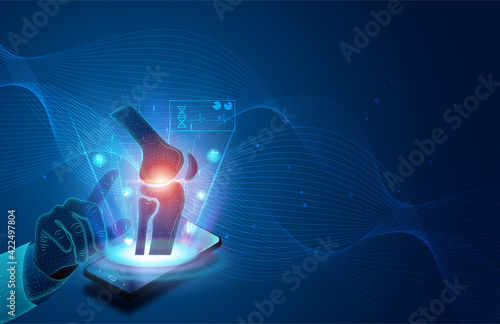 Technology for treatment of knee bone. Abstract traumatology and orthopedics. Medical science in the hospital for body joints.