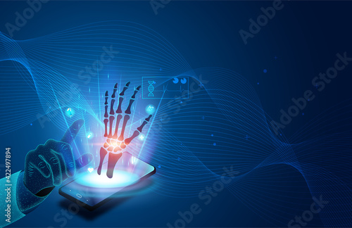 Technology for treatment of hand bone. Abstract traumatology and orthopedics. Medical science in the hospital for body joints.