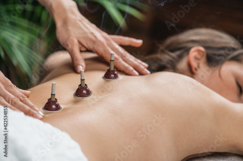Obraz na plátně Moxibustion Traditional Chinese Medicine Treatment