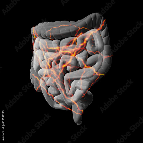 Stomach ache and pain, 3d illustration, visualizing stabbing pain with lightning strokes photo