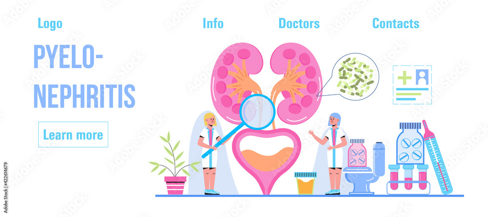 Obraz premium Urarthritis, ureteroscopy concept vector for medical website. Urologist, nephritis illustration. Tiny doctor treats kidneys. Pyelonephritis and kidney stones diseases.