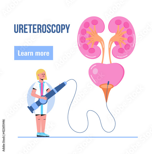 Ureteroscopy concept vector for medical website. Urologist, nephropathy illustration. Tiny doctor treat kidneys. Pyelonephritis and kidney stones diseases