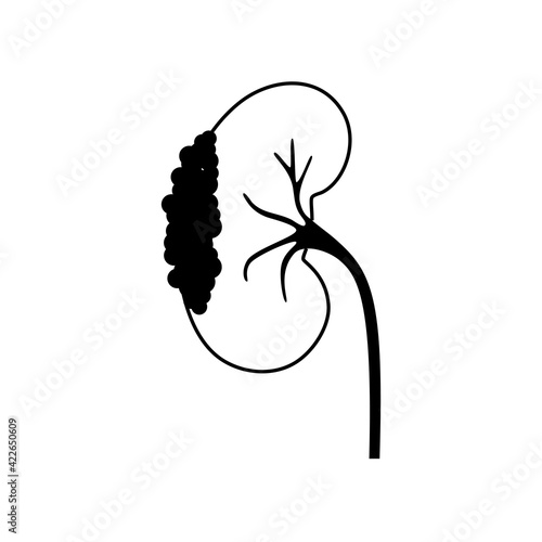Kidney disease concept