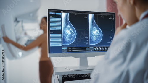 Computer Screen in Hospital Radiology Room: Beautiful Multiethnic Adult Woman Standing Topless Undergoing Mammography Screening Procedure. Screen Showing the Mammogram Scans of Dense Breast Tissues. photo