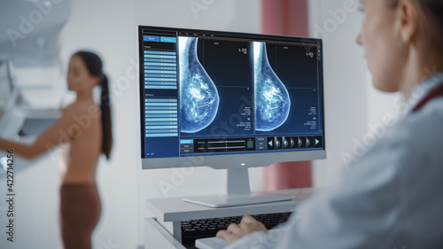 Computer Screen in Hospital Radiology Room: Beautiful Multiethnic Adult Woman Standing Topless Undergoing Mammography Screening Procedure. Screen Showing the Mammogram Scans of Dense Breast Tissues. photo