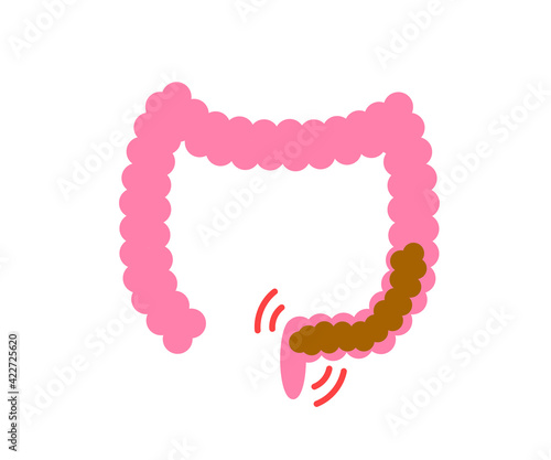 Large intestine on a white background. Constipation. Vector illustration.