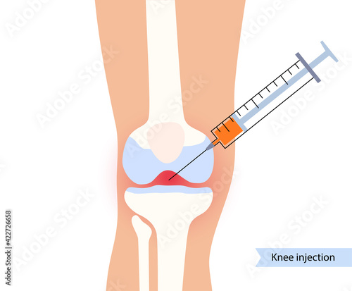 Knee Injection concept