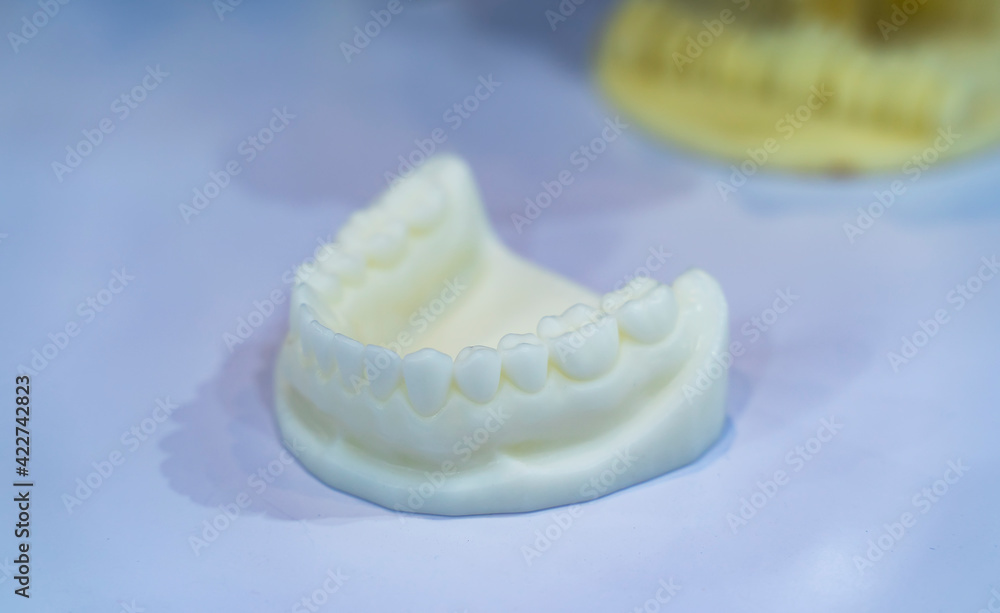 3d printer from a photopolymer material. 3d printer from a photopolymer material.