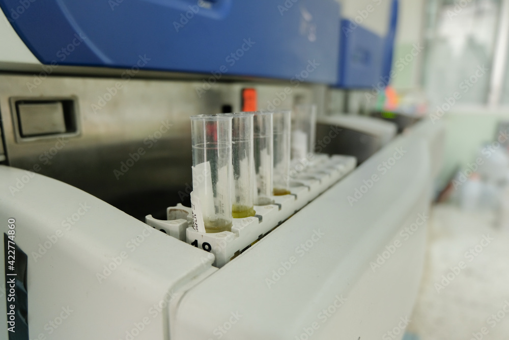 urine analysis in medical machine