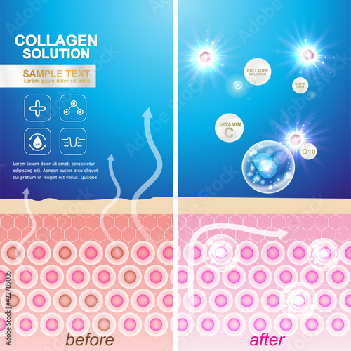 Repair Skin Layer , Collagen Serum and Vitamin Repair Skin Concept.
