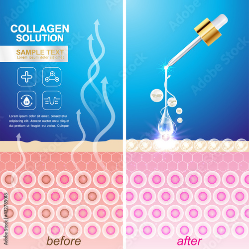 Repair Skin Layer , Collagen Serum and Vitamin Repair Skin Concept.