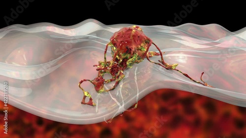 Invasive cancer growth, 3D animation showing tumor invasion into underlined tissue