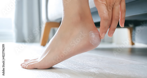 Girl apply cream on heel