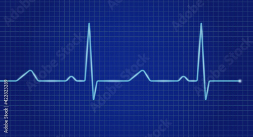 Cardiogram cardiograph oscilloscope blue screen. Heartbeat line. Vector illustration