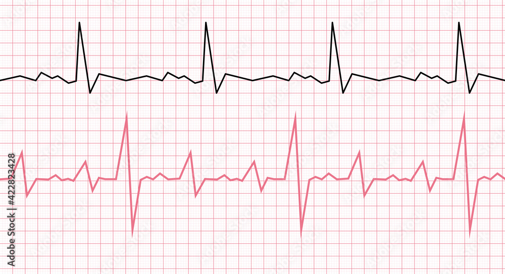 Naklejka premium Cardiogram on a graph paper. Heartbeat line. Vector illustration
