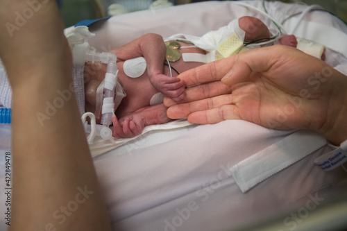 Mother's finger touching premature newborn baby's finger in incubator photo