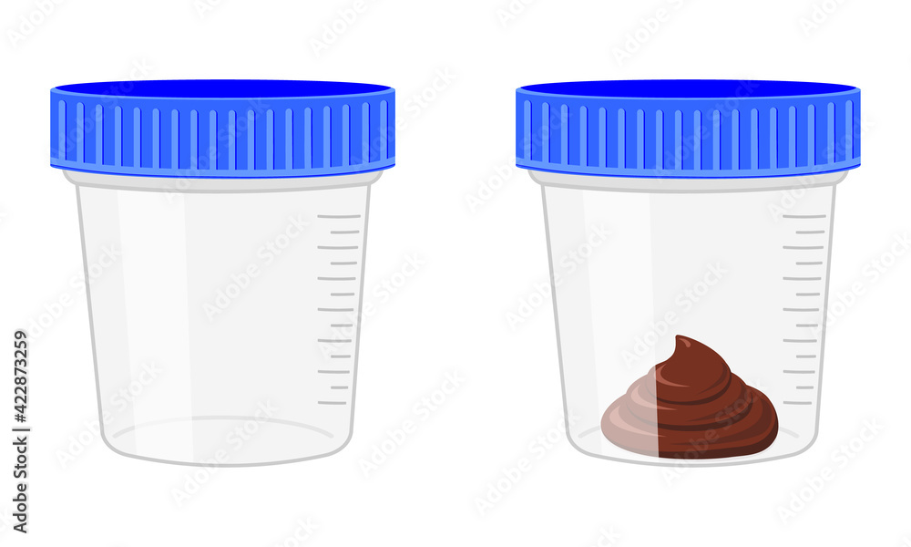 Stool sample, empty and full plastic cups. Poop analysis. Laboratory