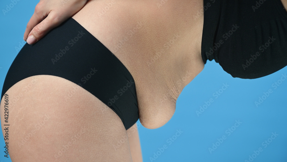 Fototapeta premium Woman in black underwear shows her belly fat on blue backdround. Body control, diet and weight loss concept