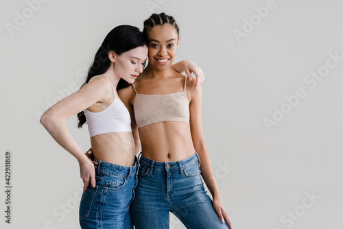 African young woman standing with caucasian woman