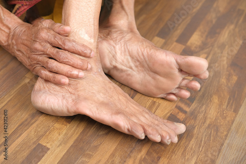Close up on senior women feet and hand massage on injury spot. © Towfiqu Barbhuiya 
