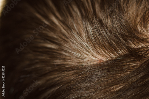 Top of the head, dark hair. Shampoo, oils, hair styling. Macro photo. Loupe, split ends.