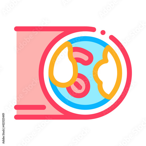 artery with atherosclerosis color icon vector illustration