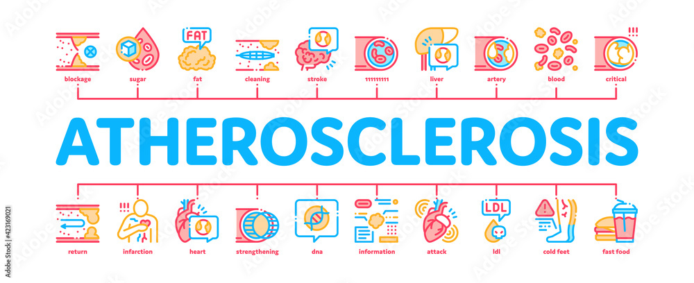 Atherosclerosis Vessel Minimal Infographic Banner Vector