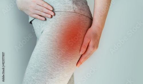 A woman suffers from piriformis syndrome, pain in buttocks muscle caused by sciatic nerve irritation photo