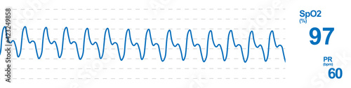 Konstfotografi Pulse oximetry monitoring