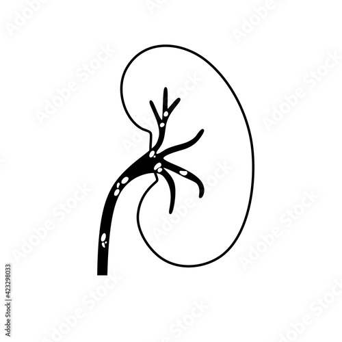 Kidney disease concept