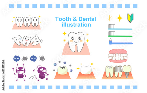 Dental character set implant periodontal disease, etc.