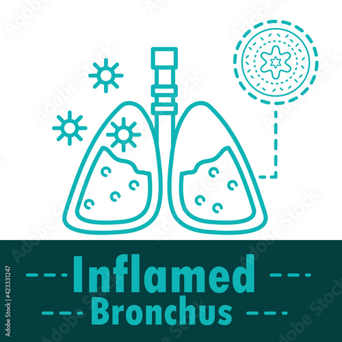 asthma inflamed bronchus