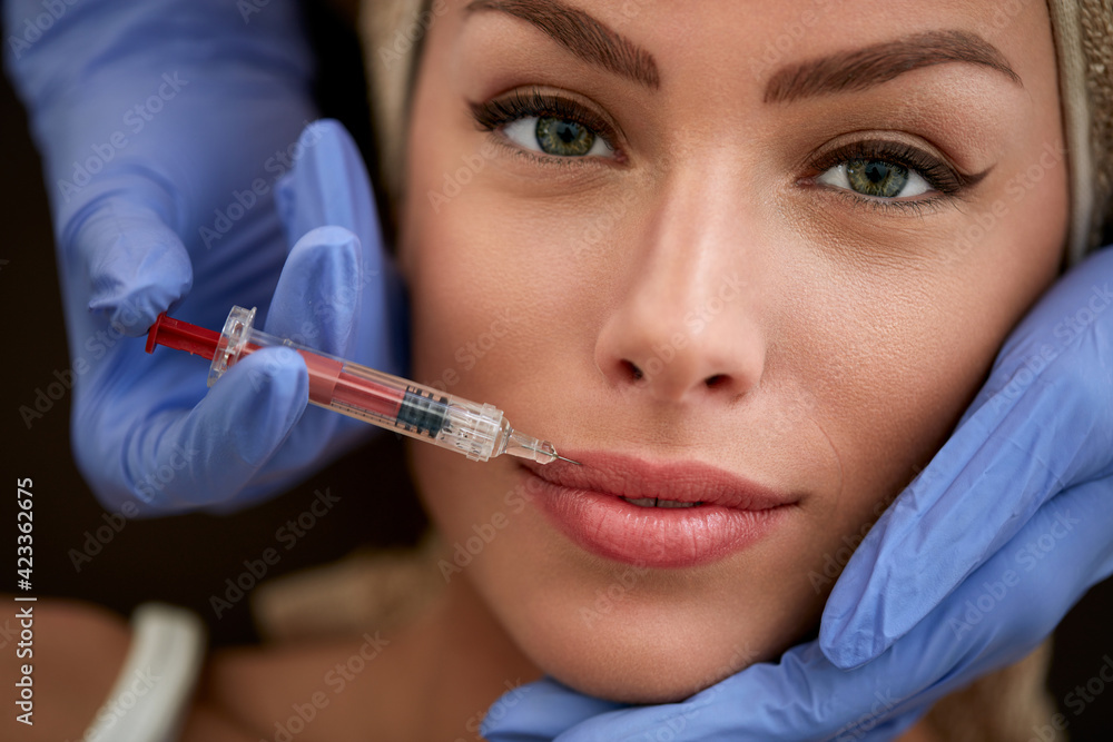 beauty and lips correction. Plastic surgery. beauty and lips correction. Plastic surgery.