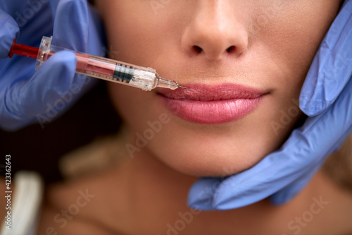 woman receiving a injection in her lips correcting simetry. Plastic surgery.