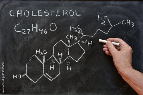 Mano escribiendo la fórmula molecular y  estructural del colesterol en una pizarra photo