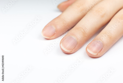 Female hand before manicure procedure